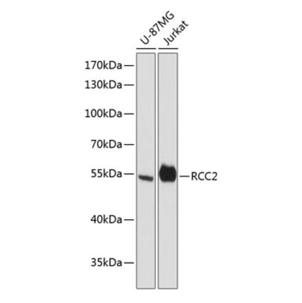 Western Blot - Anti-RCC2 Antibody (A90510) - Antibodies.com