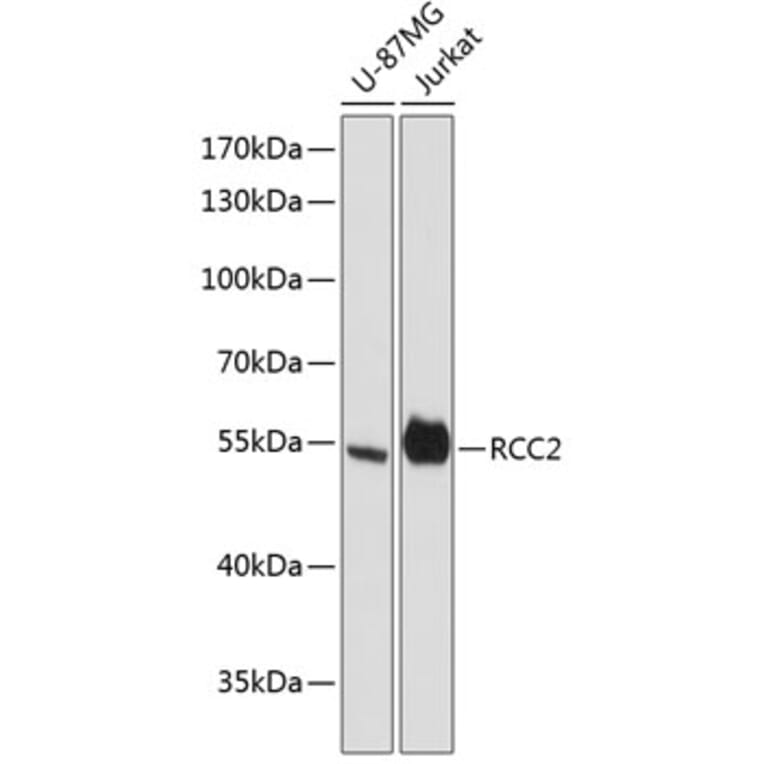 Western Blot - Anti-RCC2 Antibody (A90510) - Antibodies.com