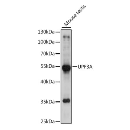 Western Blot - Anti-UPF3A Antibody (A90511) - Antibodies.com