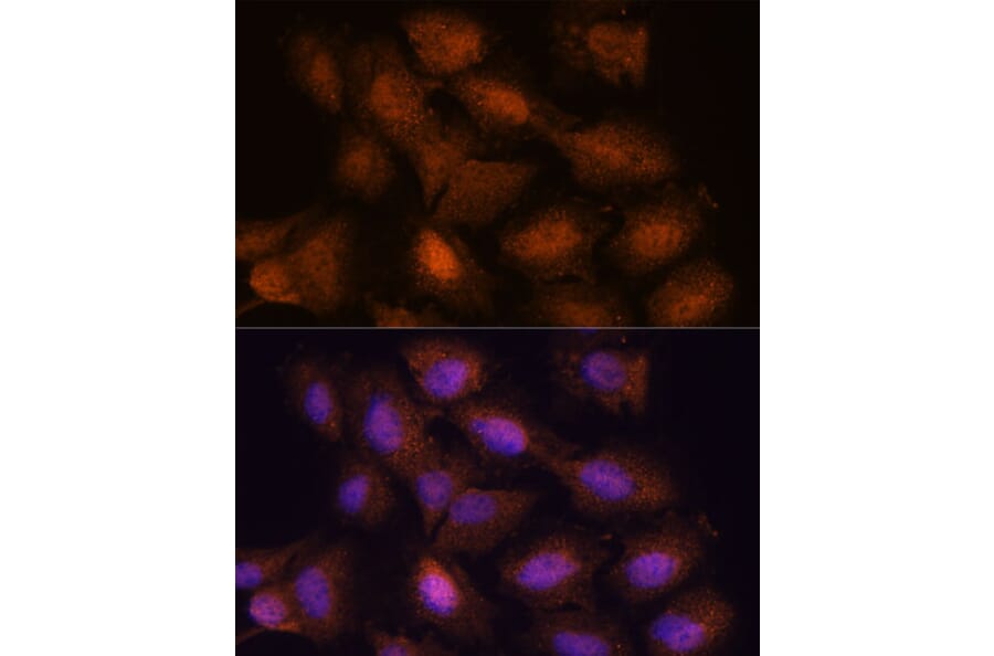 Immunofluorescence - Anti-UPF3A Antibody (A90511) - Antibodies.com