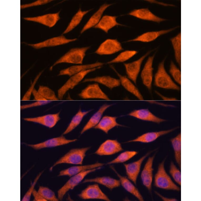 Immunofluorescence - Anti-UPF3A Antibody (A90511) - Antibodies.com