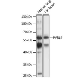 Western Blot - Anti-Nectin-4 Antibody (A90513) - Antibodies.com