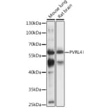 Western Blot - Anti-Nectin-4 Antibody (A90513) - Antibodies.com
