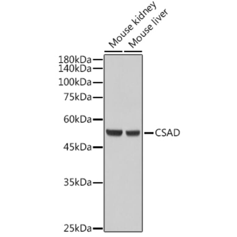 Western Blot - Anti-CSAD/CSD Antibody (A90514) - Antibodies.com