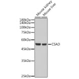 Western Blot - Anti-CSAD/CSD Antibody (A90514) - Antibodies.com