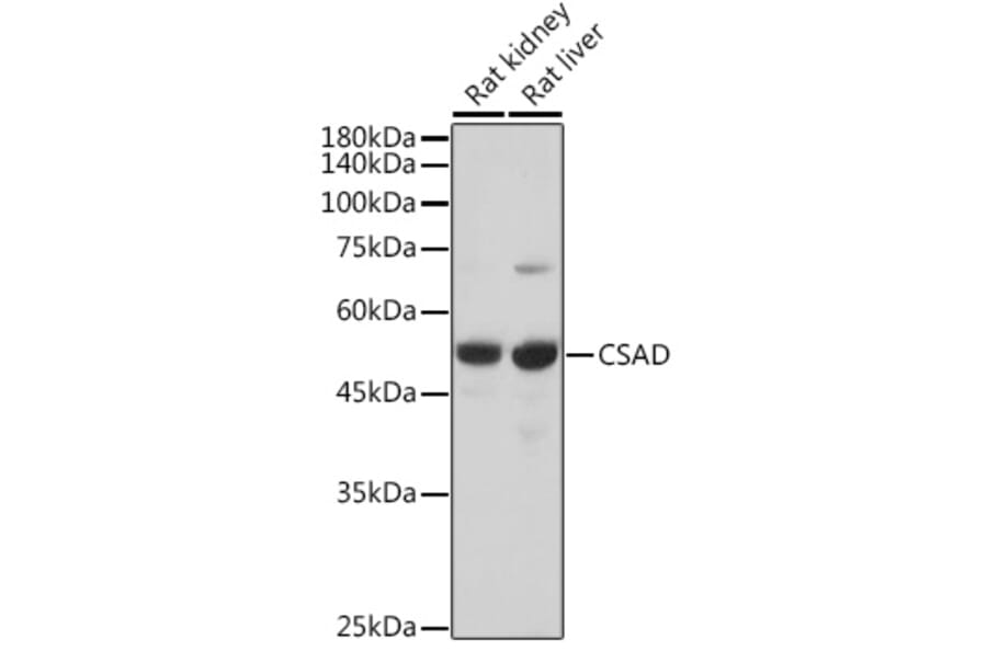 Western Blot - Anti-CSAD/CSD Antibody (A90514) - Antibodies.com