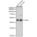 Western Blot - Anti-CSAD/CSD Antibody (A90514) - Antibodies.com