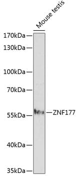 Western blot analysis of extracts of mouse testis, using Anti-ZNF177 Antibody (A14803) at 1:1,000 dilution.
Secondary antibody: Goat Anti-Rabbit IgG (H+L) (HRP) (AS014) at 1:10,000 dilution.
Lysates / proteins: 25µg per lane.
Blocking buffer: 3% non-fat dry milk in TBST.
Detection: ECL Enhanced Kit (RM00021).
Exposure time: 2.5min.