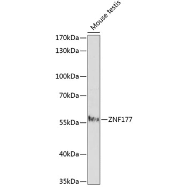 Western Blot - Anti-ZNF177 Antibody (A90517) - Antibodies.com