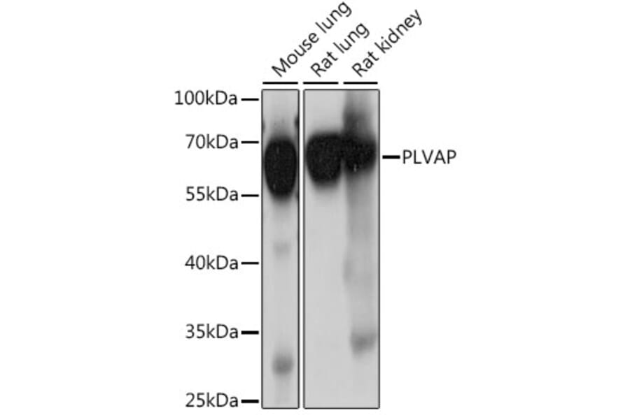 Western Blot - Anti-PLVAP/PV-1 Antibody (A90518) - Antibodies.com