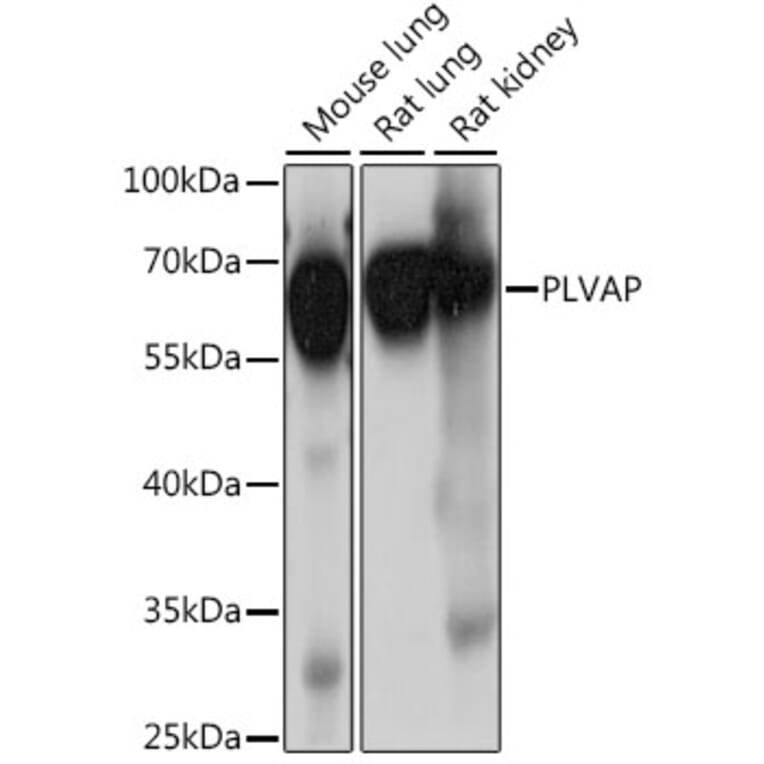 Western Blot - Anti-PLVAP/PV-1 Antibody (A90518) - Antibodies.com