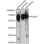 Western Blot - Anti-PLVAP/PV-1 Antibody (A90518) - Antibodies.com