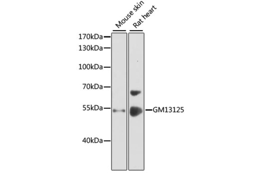 Western Blot - Anti-GM13125 Antibody (A12637) - Antibodies.com