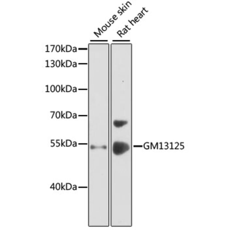 Western Blot - Anti-GM13125 Antibody (A12637) - Antibodies.com