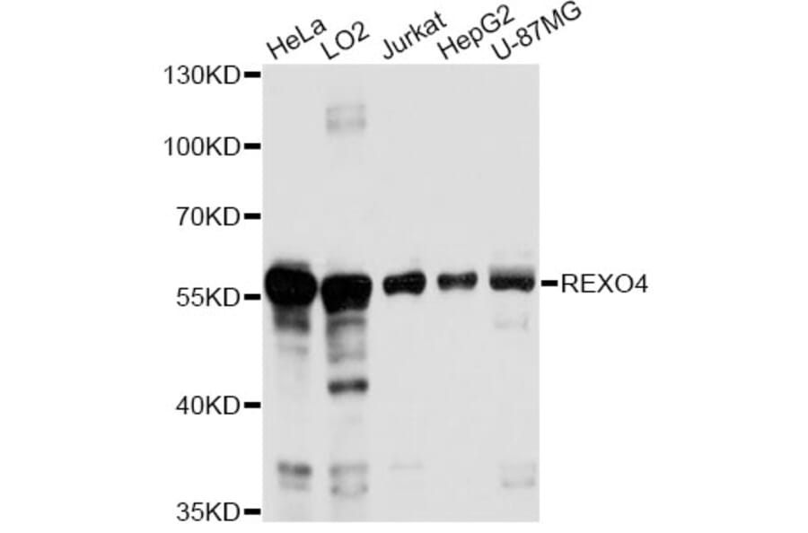 Western Blot - Anti-REXO4 Antibody (A14414) - Antibodies.com
