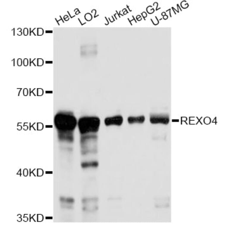 Western Blot - Anti-REXO4 Antibody (A14414) - Antibodies.com