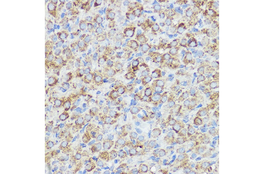 Immunohistochemistry - Anti-Abi-1 Antibody (A90521) - Antibodies.com