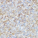 Immunohistochemistry - Anti-Abi-1 Antibody (A90521) - Antibodies.com