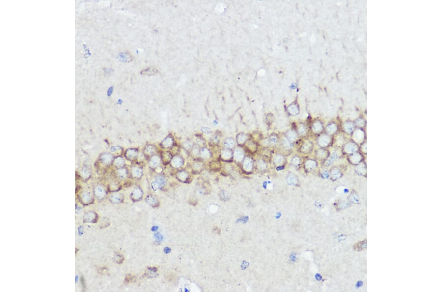 Immunohistochemistry - Anti-Abi-1 Antibody (A90521) - Antibodies.com