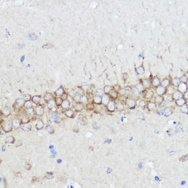 Immunohistochemistry - Anti-Abi-1 Antibody (A90521) - Antibodies.com