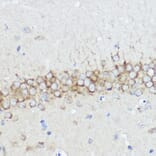 Immunohistochemistry - Anti-Abi-1 Antibody (A90521) - Antibodies.com