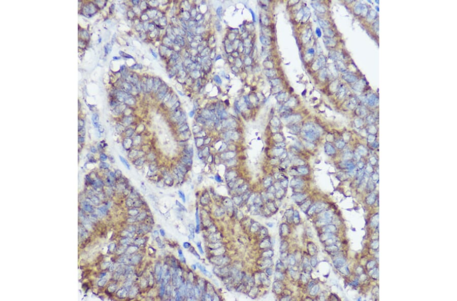 Immunohistochemistry - Anti-Abi-1 Antibody (A90521) - Antibodies.com