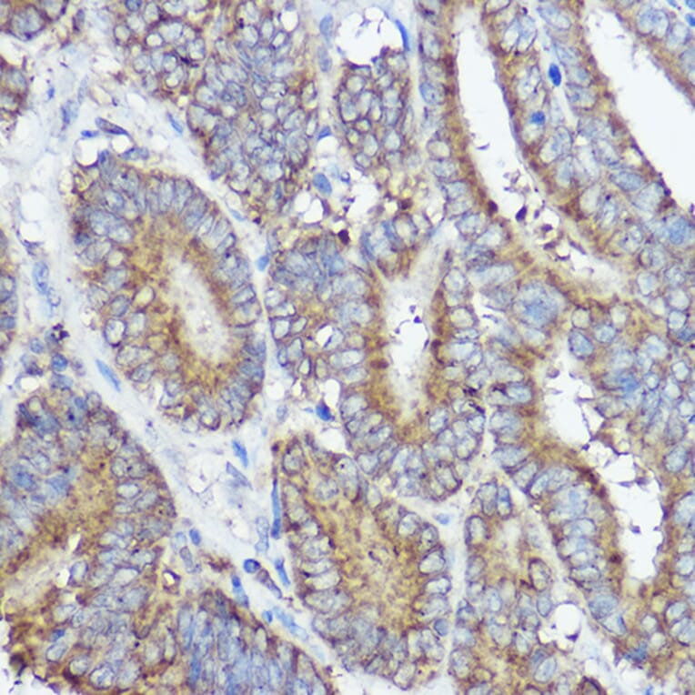 Immunohistochemistry - Anti-Abi-1 Antibody (A90521) - Antibodies.com