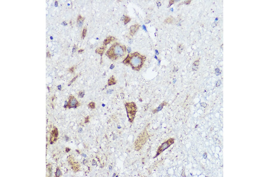 Immunohistochemistry - Anti-Abi-1 Antibody (A90521) - Antibodies.com