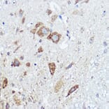 Immunohistochemistry - Anti-Abi-1 Antibody (A90521) - Antibodies.com