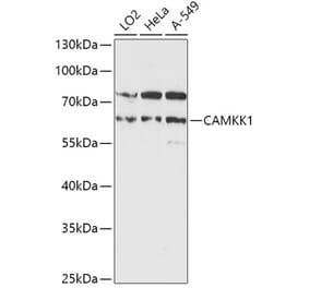 Western Blot - Anti-CAMKK1 Antibody (A90522) - Antibodies.com