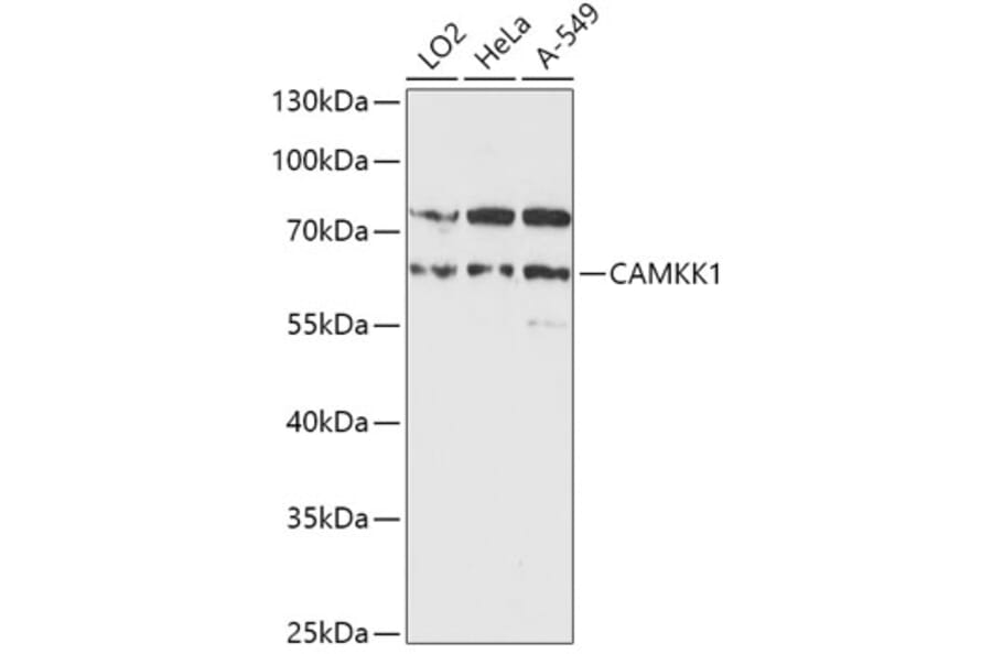 Western Blot - Anti-CAMKK1 Antibody (A90522) - Antibodies.com