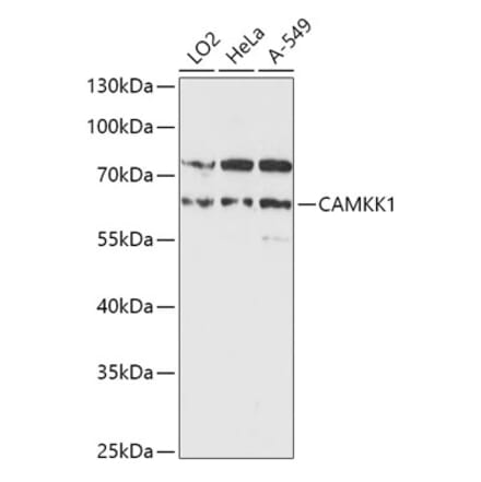 Western Blot - Anti-CAMKK1 Antibody (A90522) - Antibodies.com