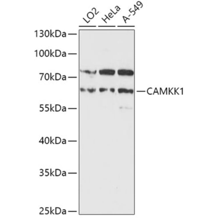 Western Blot - Anti-CAMKK1 Antibody (A90522) - Antibodies.com