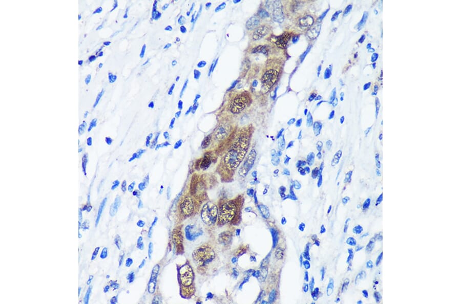 Immunohistochemistry - Anti-CAMKK1 Antibody (A90522) - Antibodies.com