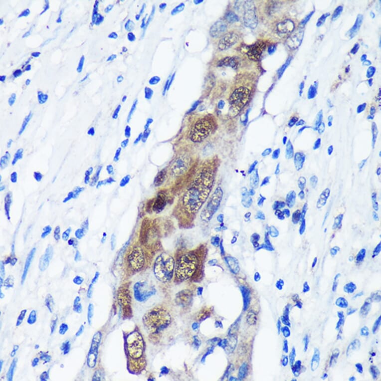 Immunohistochemistry - Anti-CAMKK1 Antibody (A90522) - Antibodies.com