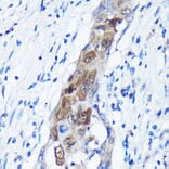 Immunohistochemistry - Anti-CAMKK1 Antibody (A90522) - Antibodies.com