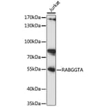 Western Blot - Anti-RABGGTA Antibody (A90523) - Antibodies.com