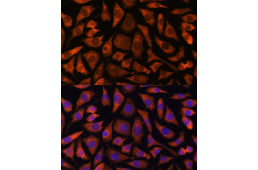 Immunofluorescence - Anti-RABGGTA Antibody (A90523) - Antibodies.com