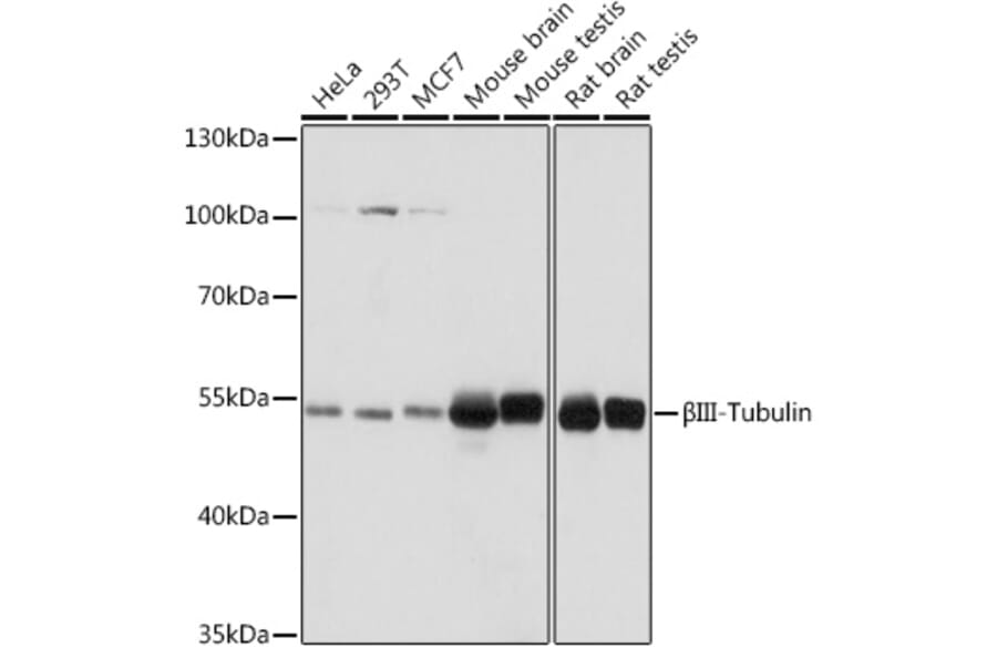 Western Blot - Anti-beta III Tubulin Antibody (A90524) - Antibodies.com