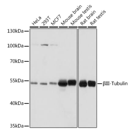 Western Blot - Anti-beta III Tubulin Antibody (A90524) - Antibodies.com