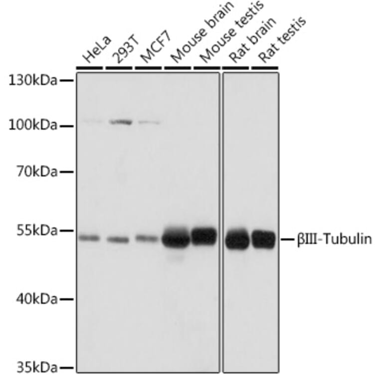 Western Blot - Anti-beta III Tubulin Antibody (A90524) - Antibodies.com