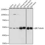 Western Blot - Anti-beta III Tubulin Antibody (A90524) - Antibodies.com