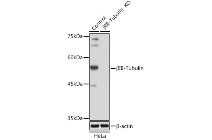 Western Blot - Anti-beta III Tubulin Antibody (A90524) - Antibodies.com