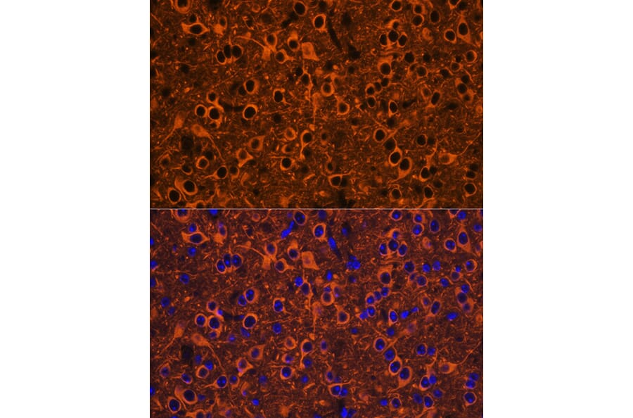 Immunofluorescence - Anti-beta III Tubulin Antibody (A90524) - Antibodies.com