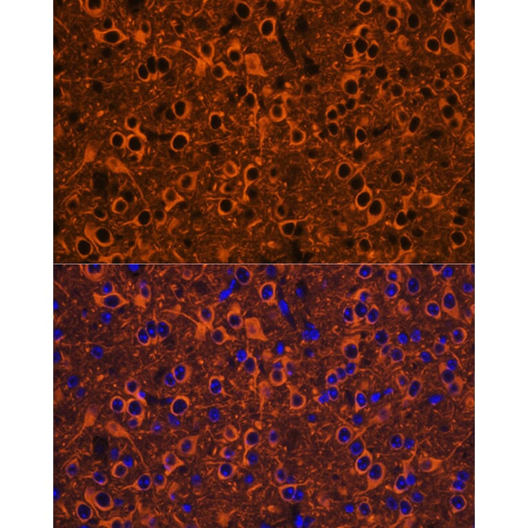 Immunofluorescence - Anti-beta III Tubulin Antibody (A90524) - Antibodies.com