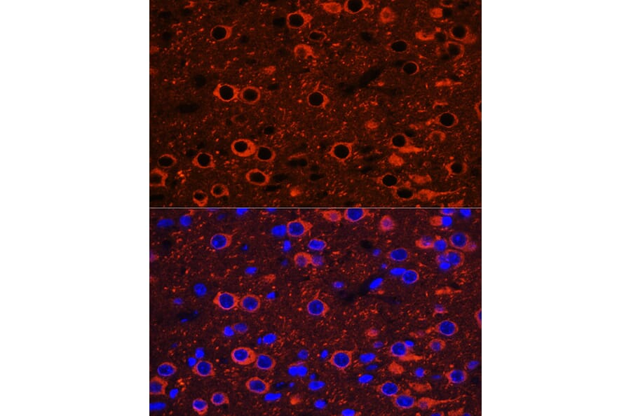 Immunofluorescence - Anti-beta III Tubulin Antibody (A90524) - Antibodies.com
