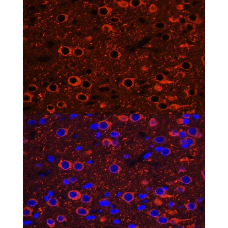 Immunofluorescence - Anti-beta III Tubulin Antibody (A90524) - Antibodies.com