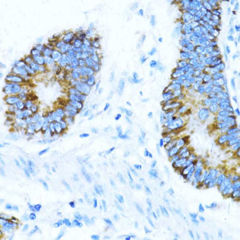 Immunohistochemistry - Anti-NOX1 Antibody (A90525) - Antibodies.com