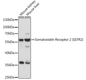 Western Blot - Anti-Somatostatin Receptor 2 Antibody (A90526) - Antibodies.com