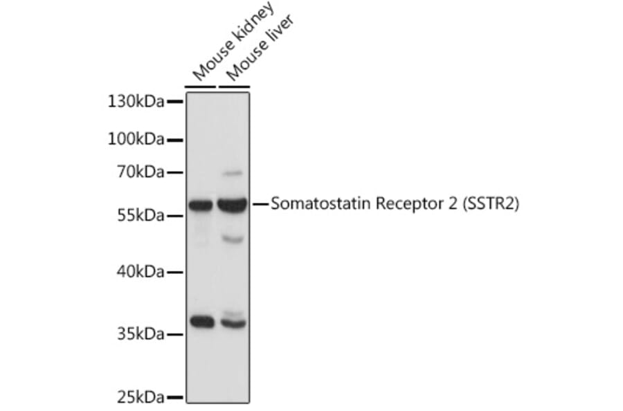 Western Blot - Anti-Somatostatin Receptor 2 Antibody (A90526) - Antibodies.com